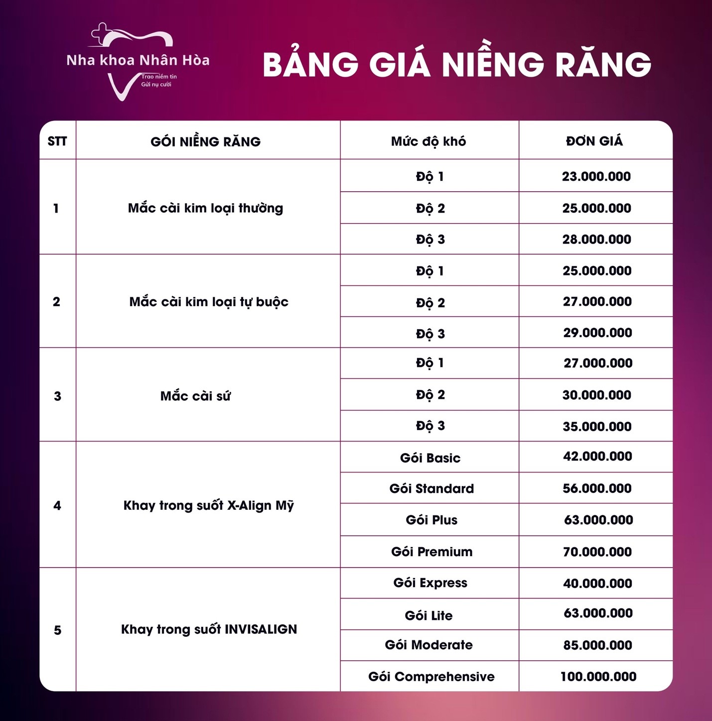 Bảng giá niềng răng