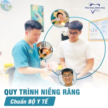 Quy trình niềng răng chuẩn quốc tế tại Nha khoa Nhân Hòa